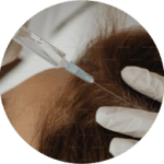 Holistic hair clinic specialist brampton