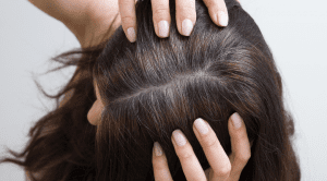 Hair Loss From Hair Dye: Will It Grow Back?